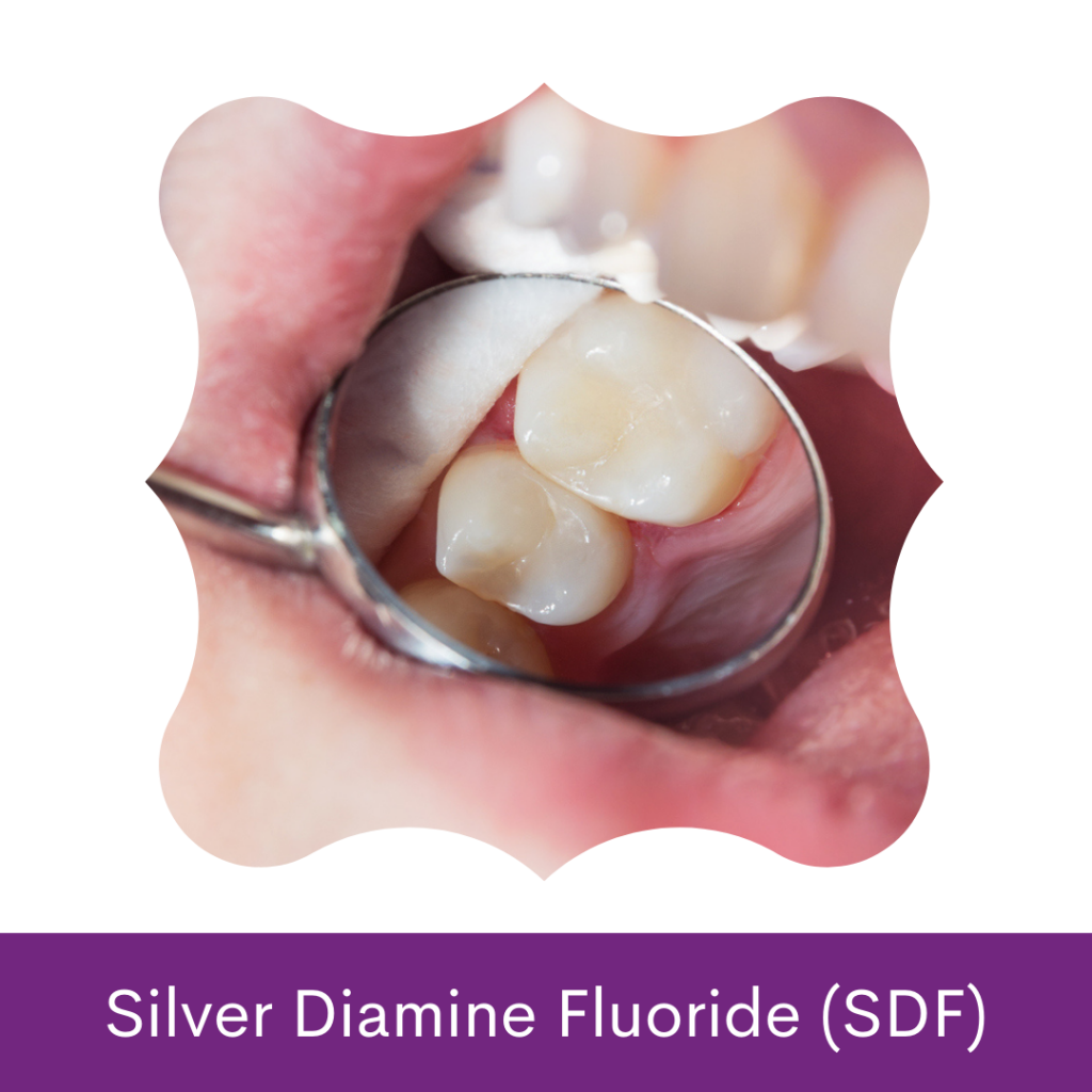 Silver Diamine Fluoride (SDF) Roving Dental Hygiene